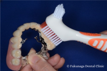 テレスコープ義歯の歯磨きどうしていますか？